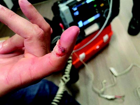 Man accused of biting ICE officer's finger during arrest in downtown L.A.