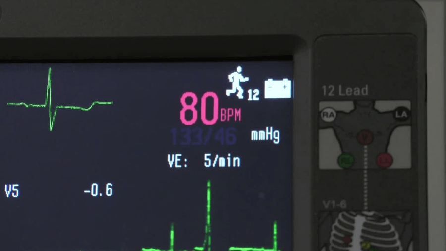 Who needs a statin? New Intermountain Study compares prescribing recommendations based on traditional risk factors vs. coronary artery calcium scoring