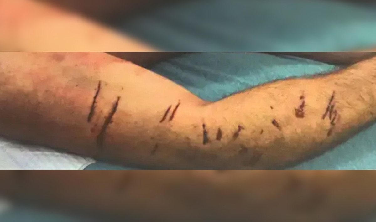 USC Medical School Professor Testifies Karen Read Boyfriend 'Attacked' By Dog Before Death