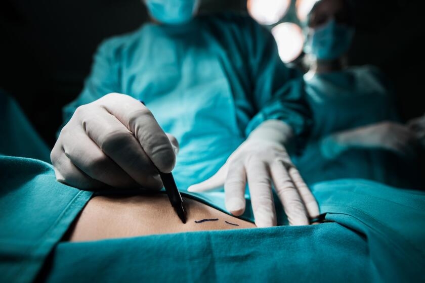 Nude photos of Beverly Hills plastic surgery patients exposed in data hacks, lawsuit alleges