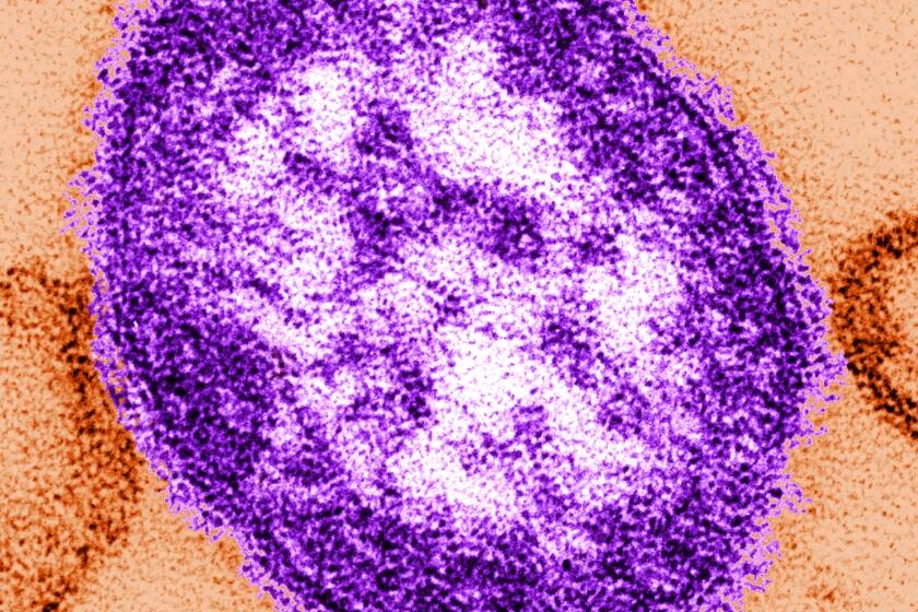 Letters to the Editor: Strong reporting is a reminder that even mild measles cases can lead to serious disease
