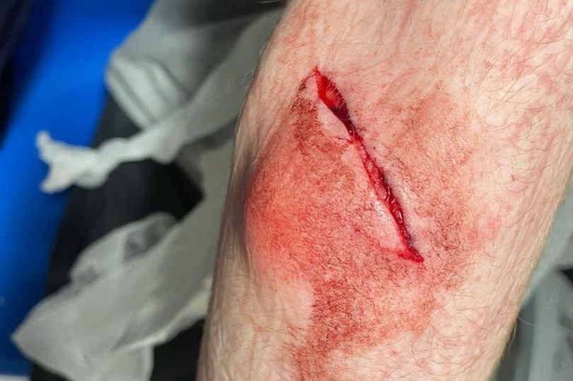 Teen ambushed and attacked with machete in horror robbery at nature reserve