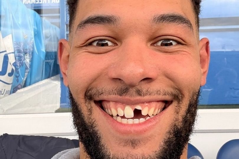 The toothless striker who helped fire Bury FC to glory