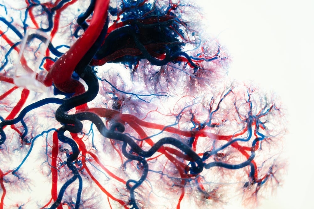 Penumbra may gain market share in peripheral embolisation coils with Ruby XL