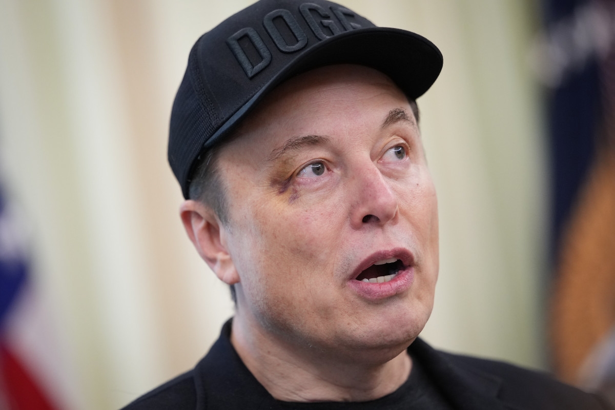 Elon Musk Shows Up With Black Eye to Major Event