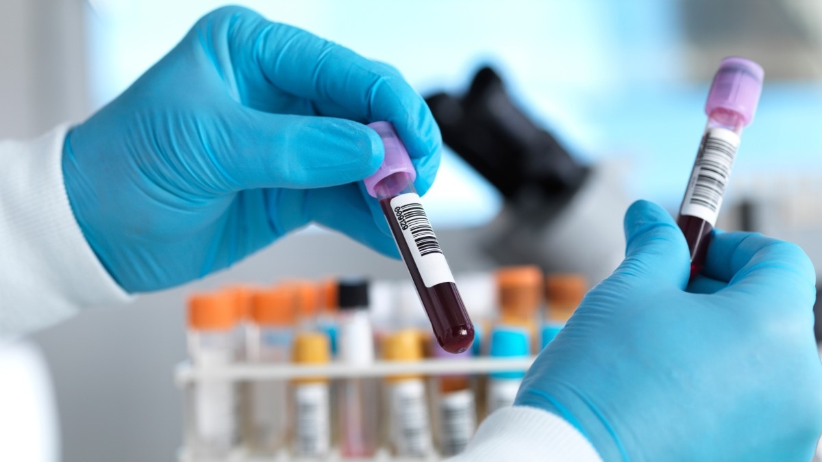FDA Approves First-Ever Blood Test for Alzheimer's—Here's What We Know