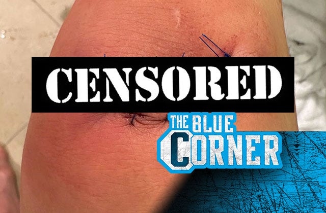 That's gonna leave a mark: Tatiana Suarez shares graphic photo of stitched-up knee gash