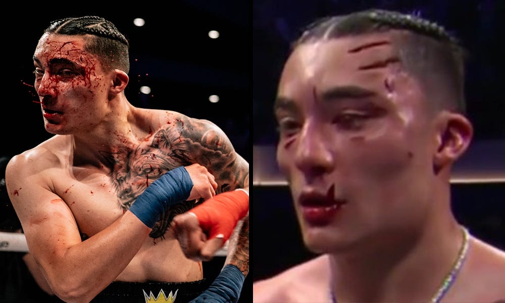 'Did he fight Wolverine?': BKFC's Ramiro Figueroa suffers nasty cuts in loss