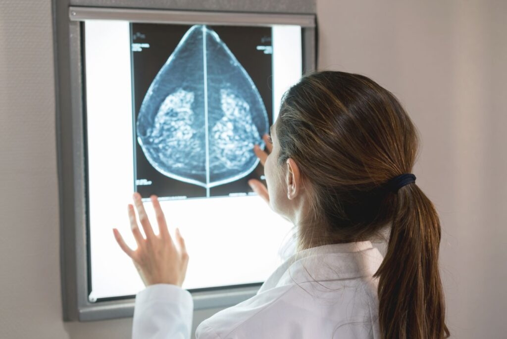 'We should be mad as hell': NC legislators who've survived breast cancer seek improved detection