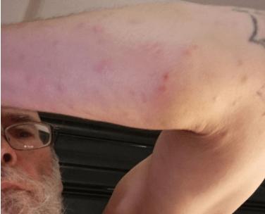Nebraska Legislature lets Pillen's veto bite bedbug bill