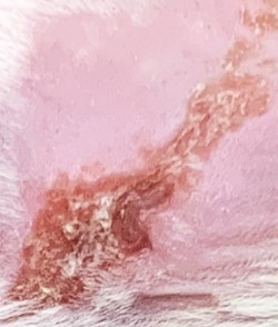 Ruvidar Effective in the Treatment of Herpes