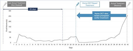Home OCT Impacts Physician Decision Making