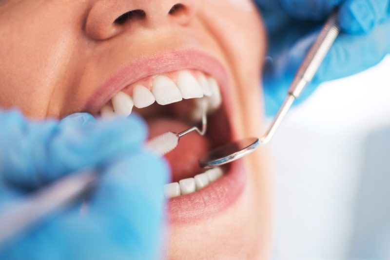Dental expenses you can pay for using an HSA