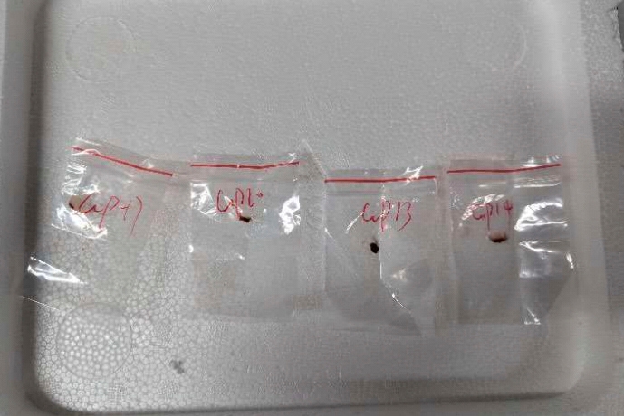 Chinese scientist faces hearing after pathogen seized by FBI