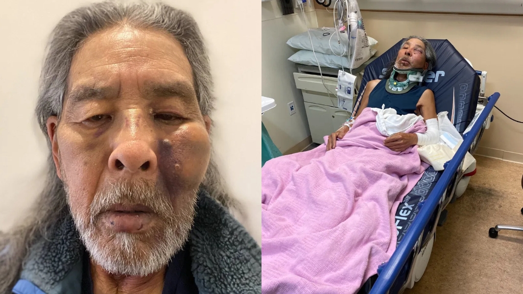 Japanese American professor who lectures on racism is targeted in racist attack
