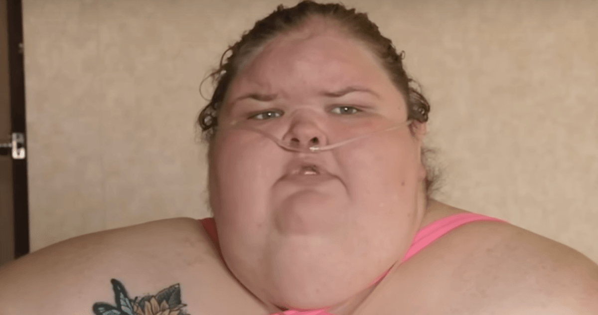 Tammy Slaton Is Unrecognizable After Excess Skin Removal & 500-Pound Weight Loss