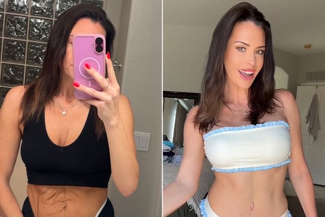 Woman, 35, Travels to Turkey for Mommy Makeover After Having 3 Kids. The Result and Price Are Equally Shocking (Exclusive)