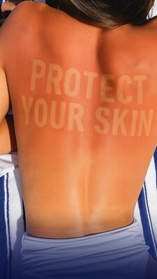 LA ROCHE-POSAY AND GLOBAL SKIN HEALTH EXPERTS UNITE TO WARN ABOUT LONG TERM CONSEQUENCES OF DANGEROUS 'BURN LINES' SOCIAL MEDIA TREND