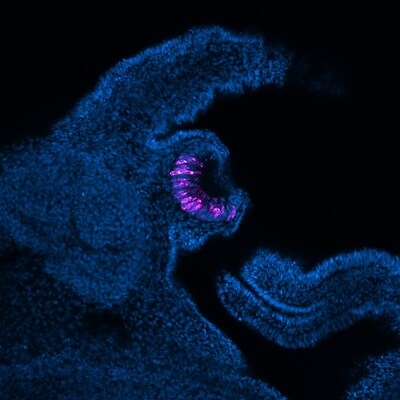 Seeing with fresh eyes: Stowers Scientists establish snails as a system for studying sight restoration