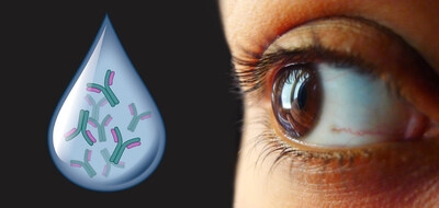 FDA Grants IND Clearance for Immunoglobulin Eye Drops to Treat Dry Eye Disease Patients in a Phase II Clinical Study