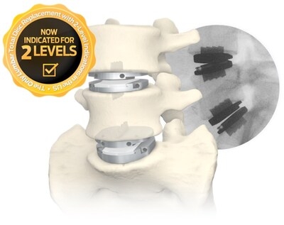 Centinel Spine® Continues to Innovate in Lumbar Total Disc Replacement through the Release of New prodisc® L Instrumentation