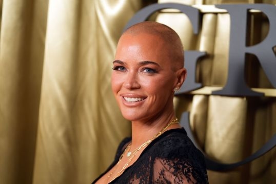 Teddi Mellencamp Gives Health Update After ‘Getting Headaches Again' (June 2025)