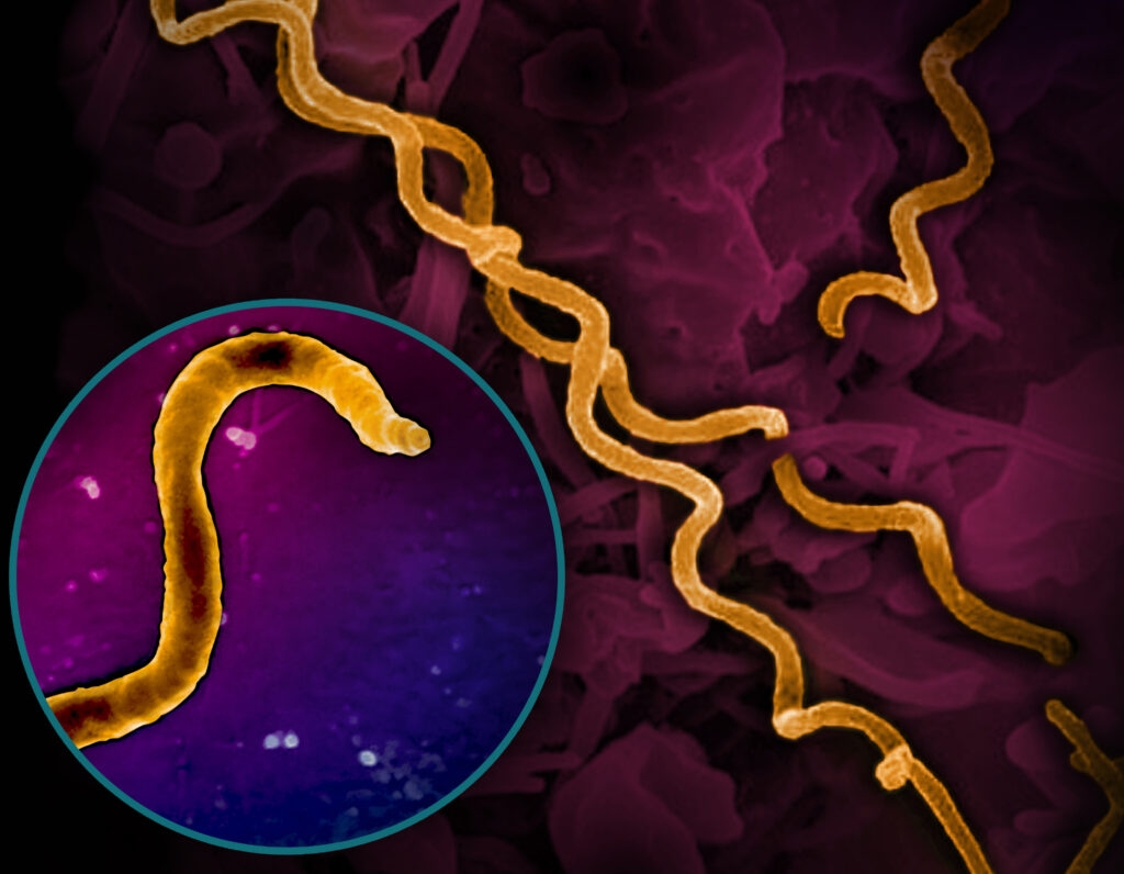 Sexually transmitted infections returning to pre-pandemic levels in Rhode Island