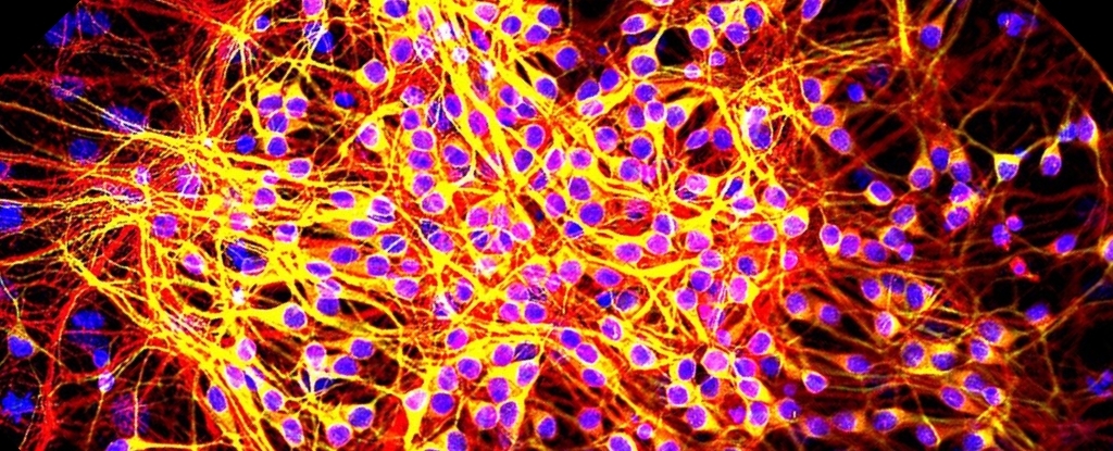 FDA-Approved Sleeping Pill Slows Alzheimer's Tangles in Pre-Clinical Trial