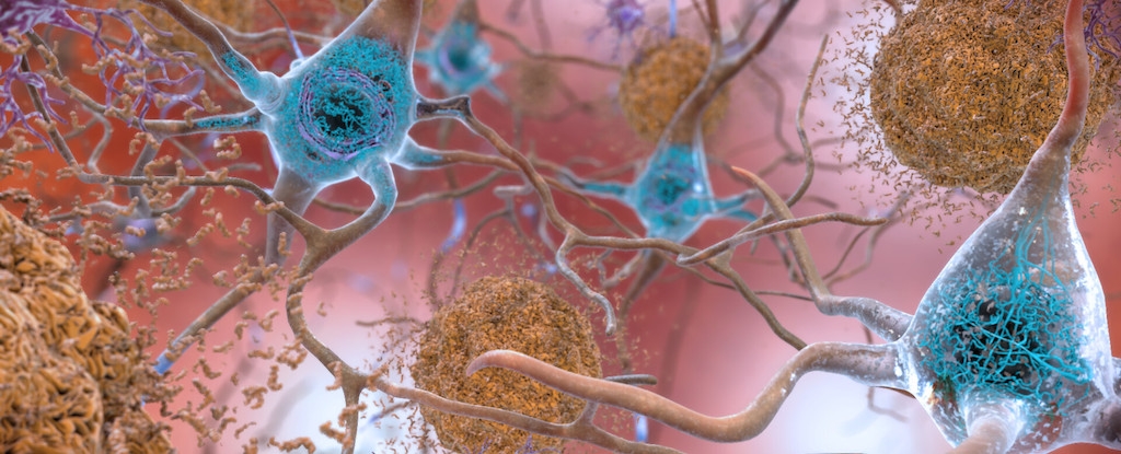 Reducing Your 'Bioenergetic Age' May Ward Off Alzheimer's, Study Finds