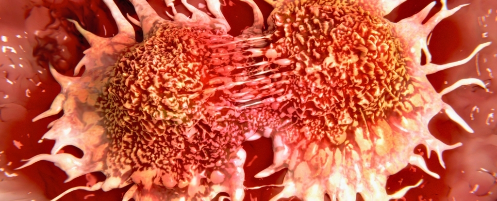 Common Viruses May Wake Dormant Breast Cancer Cells, Study Finds