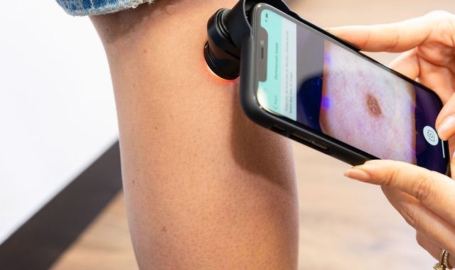 Skin cancer detection firm lands £15m to fund growth plans