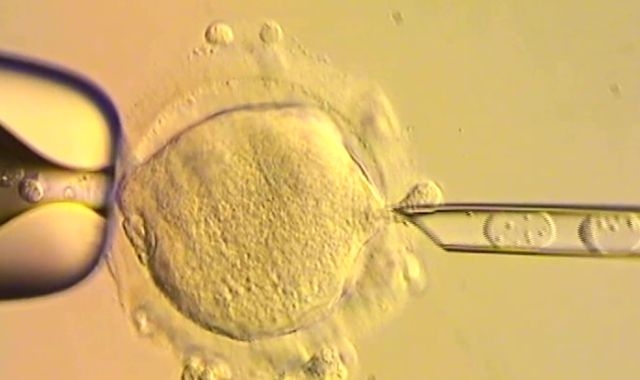 Babies born in UK with DNA from three people to treat inherited disease takes medicine into uncharted territory