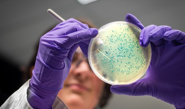 Salmonella cases reach highest levels in a decade