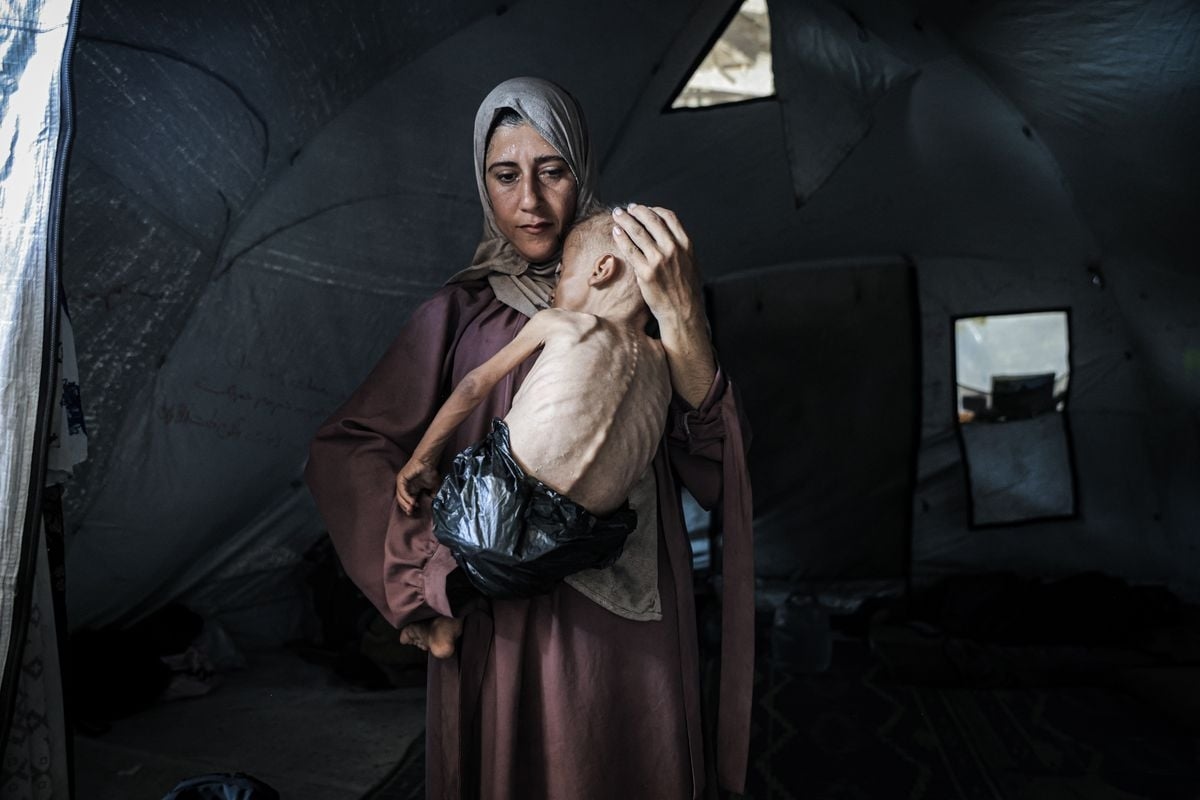 Posts claim image of emaciated boy doesn't represent mass starvation in Gaza. Here's context