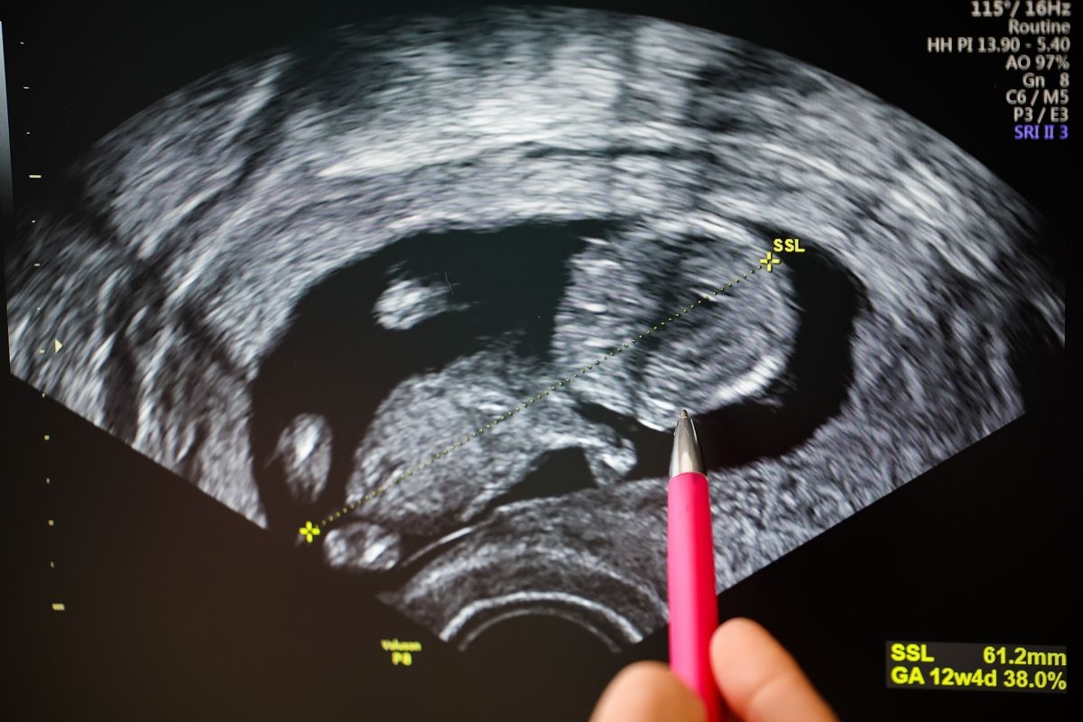 Fact Check: Unraveling claim Louisiana voted to force 9-year-old rape victim to carry pregnancy