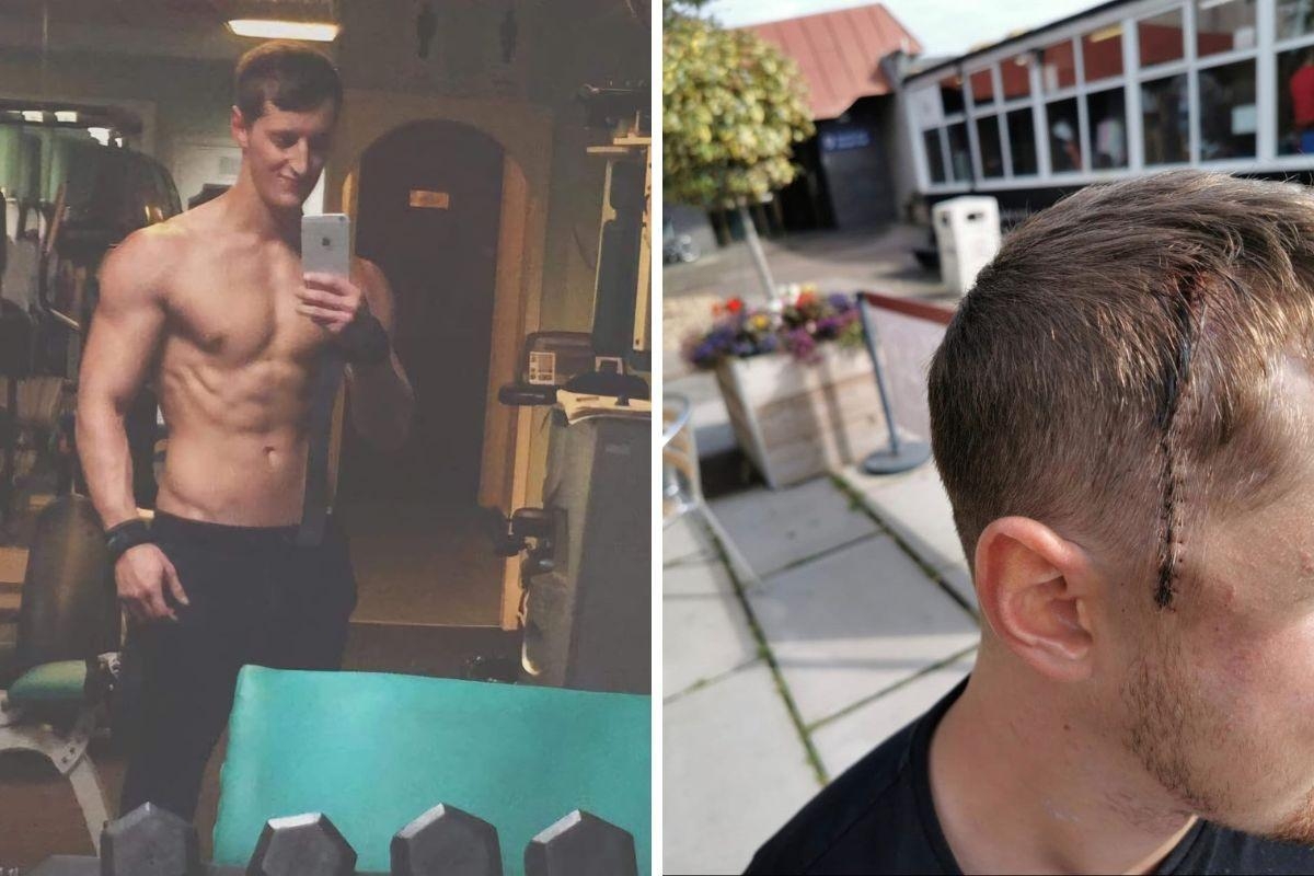 Weightlifter, 31, diagnosed with "deadly" brain tumour