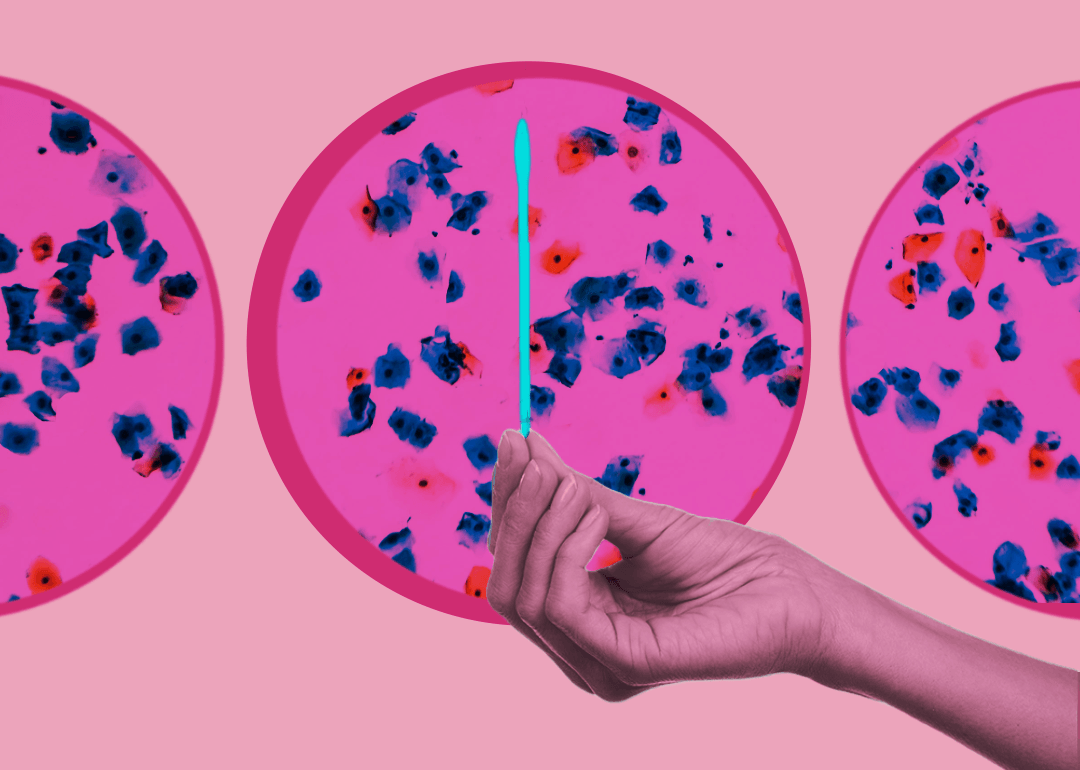 Could the FDA's recently approved Pap smear alternative reduce racial disparities in cervical cancer deaths?