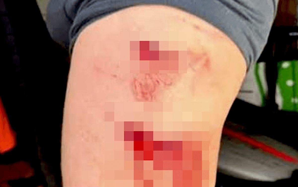 Hydrofoil Surfer Chomped by 8-Foot Shark in Canary Islands