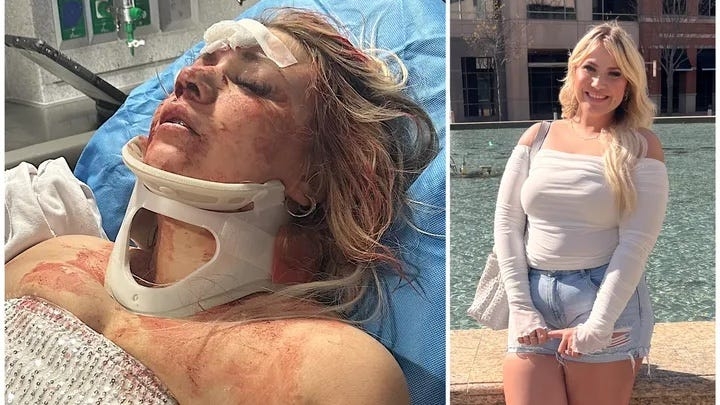 Oklahoma bride-to-be facing thousands in medical bills after attack outside Dallas bar