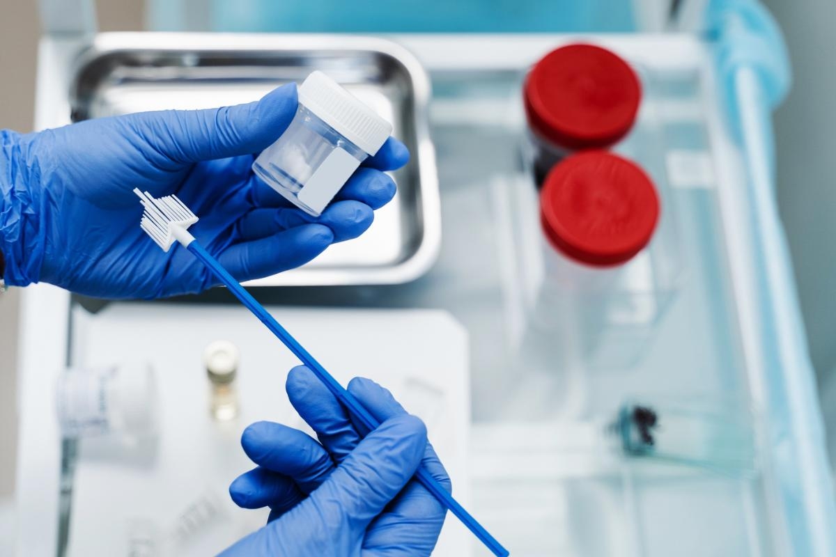 DIY cervical cancer tests to be introduced for women to do at home