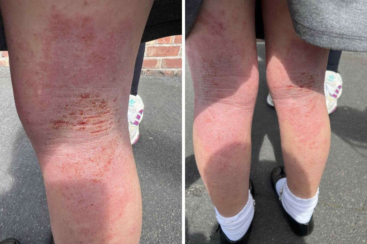 Parents fined £640 for taking daughters out of school for medical treatment