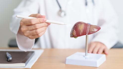 A promising new approach to treating potentially deadly liver disease