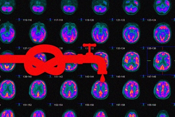 The Costs of Research Funding Delays at NIH