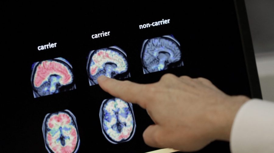 FDA clears first blood test to reliably predict Alzheimer's disease