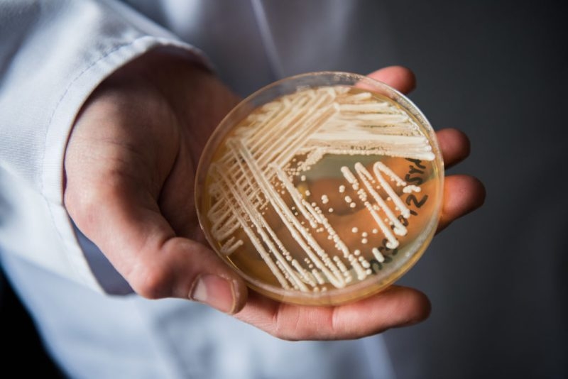 Fungus labeled ‘urgent threat' by CDC is spreading rapidly, hospital study finds