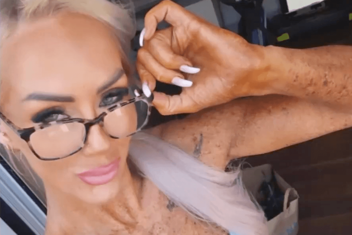 ‘It stings to put my hand under the tap': Former sunbed user warns of dangers after 12 years of tanning