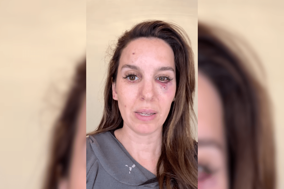 Ex-Disney star Christy Carlson Romano shot in the face during husband's birthday party