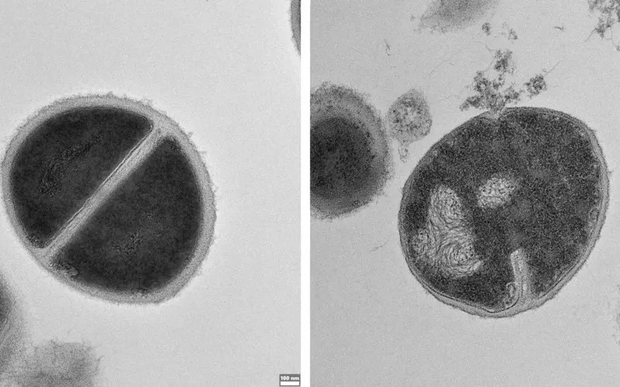 Team behind immunity breakthrough plan to unleash ‘natural antibacterials' on AMR superbugs