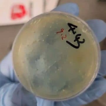 Wuhan scientist arrested for smuggling toxic parasites into US