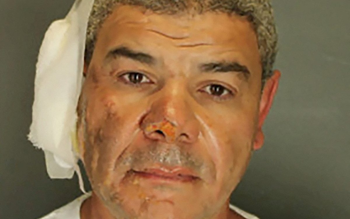 ‘Illegal migrant' arrested in pro-Israel rally attack burnt his own face